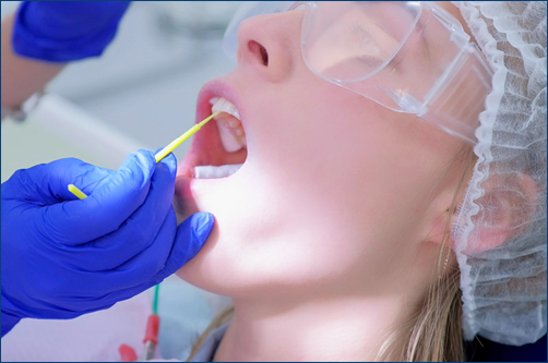 Fluoride Treatments2