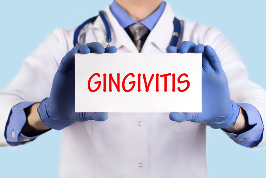 Gingivitis5