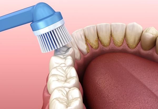 Preventive Dentistry2