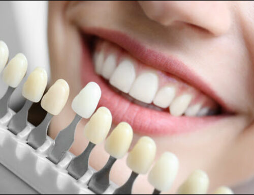 Cosmetic Dentistry to Enhance Your Smile