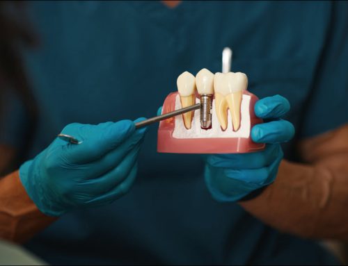 Dental Implants: A Long-Lasting Solution for Missing Teeth
